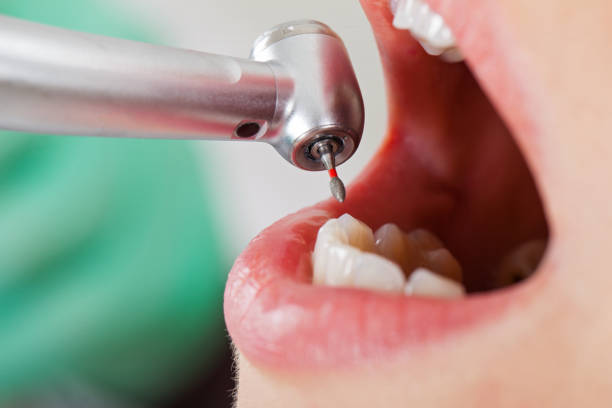 Best Urgent Dental Care for Toothache in Quantico Base, VA